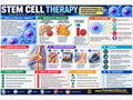 Stem Cell Therapy patient education infographic poster, full design view
