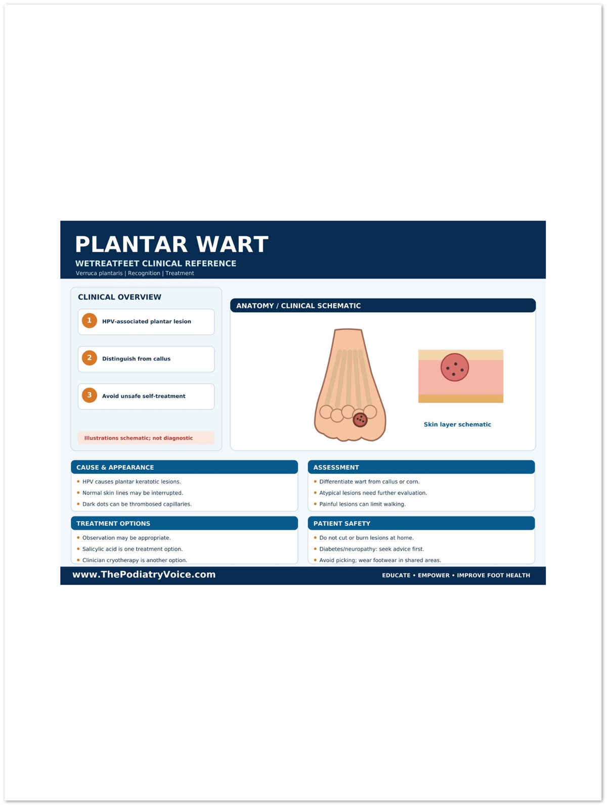 Plantar Wart Clinical Reference poster anatomical illustration detail for podiatry clinics