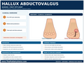 Hallux Abductovalgus educational poster covering symptoms, treatment, and prevention