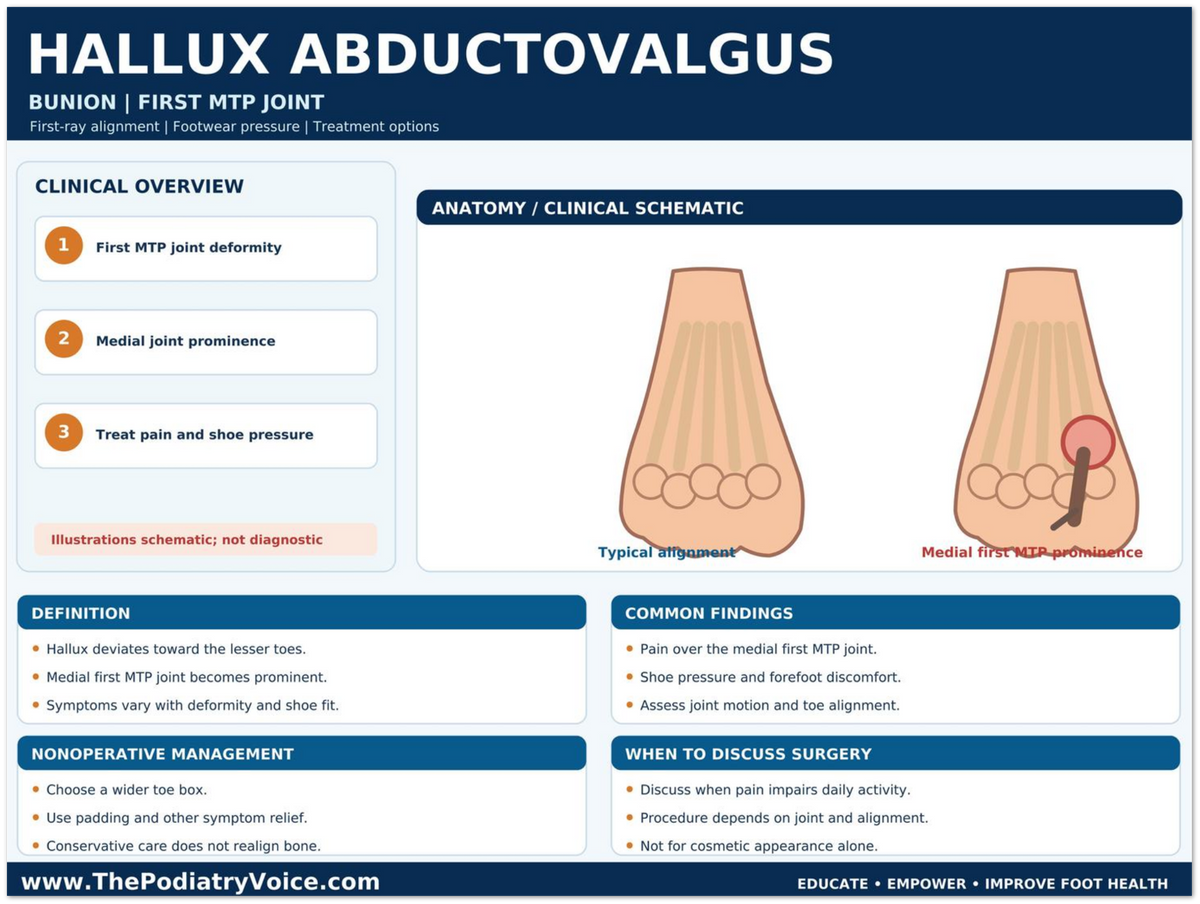 Hallux Abductovalgus educational poster covering symptoms, treatment, and prevention