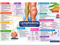 Lymphedema poster anatomical illustration detail for podiatry clinics