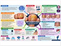 Onychomycosis poster anatomical illustration detail for podiatry clinics