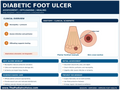 Diabetic Foot Ulcer poster anatomical illustration detail for podiatry clinics