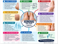 Xerosis patient education infographic poster, full design view