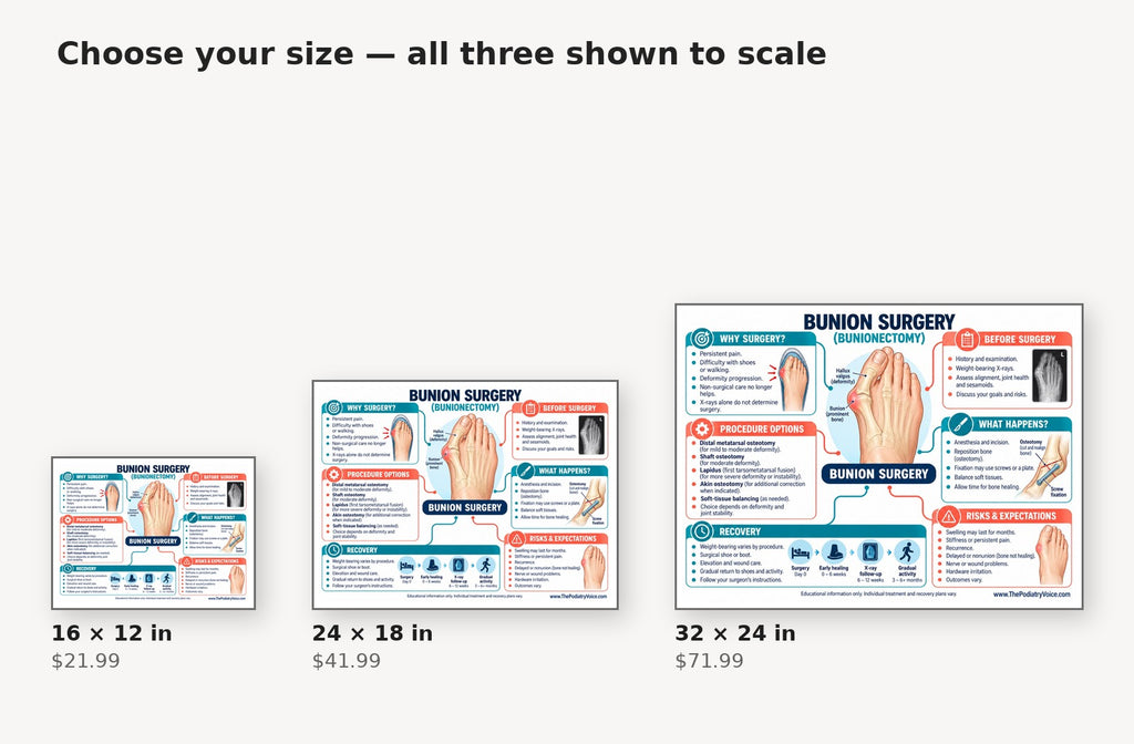 Size comparison of the bunion surgery poster in 16 by 12, 24 by 18, and 32 by 24 inch sizes
