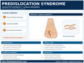 Predislocation Syndrome Clinical Reference educational poster covering symptoms, treatment, and prevention