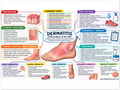 Foot & Ankle Dermatitis educational poster covering symptoms, treatment, and prevention
