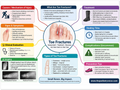 Toe Fracture poster anatomical illustration detail for podiatry clinics