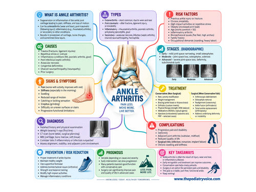 Ankle Arthritis patient education poster for podiatry clinics
