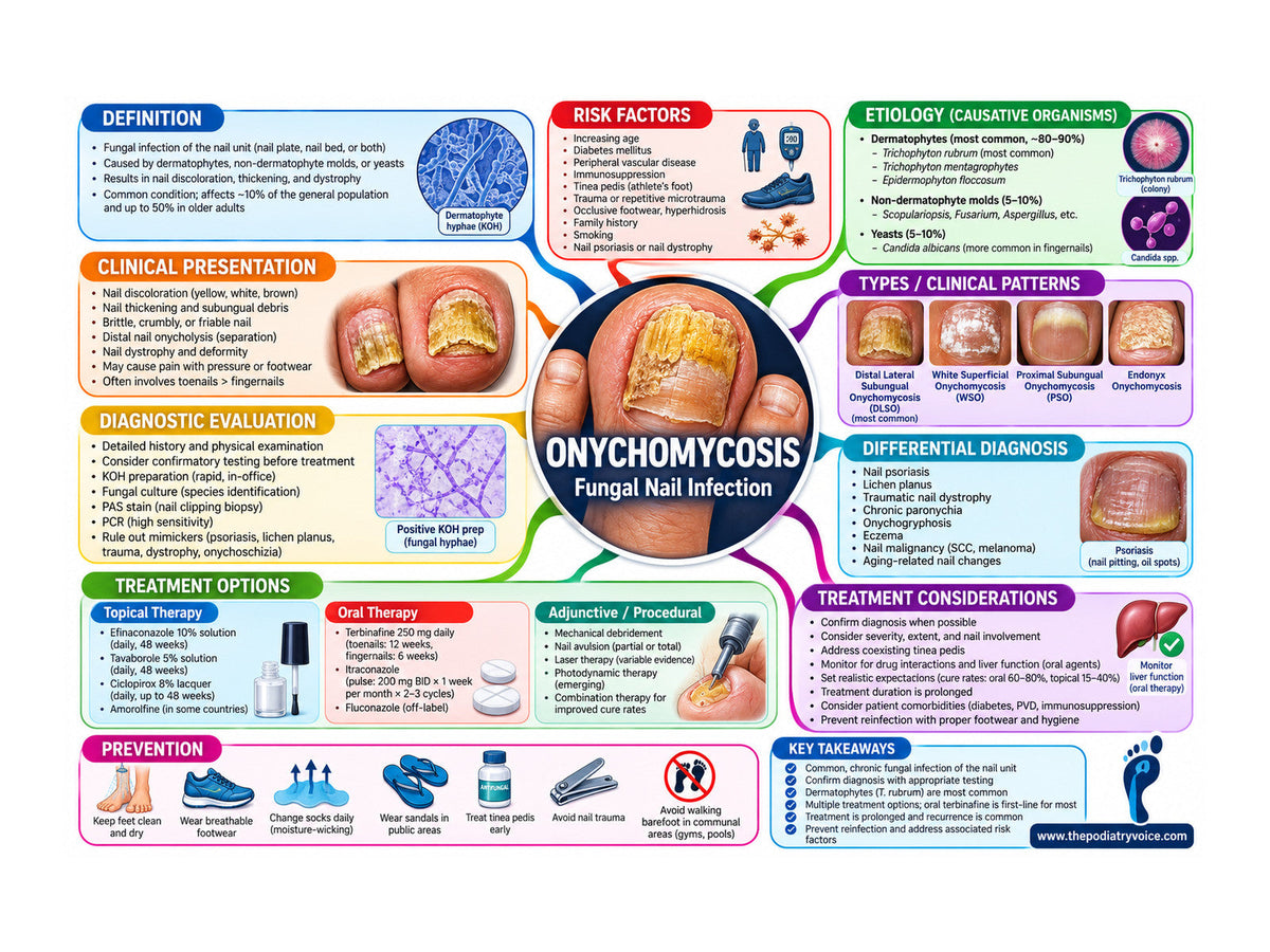 Onychomycosis patient education poster for podiatry clinics